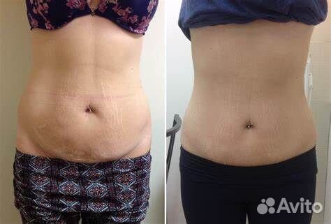 Массаж классический/ Лимфодренажный/ Японский лица