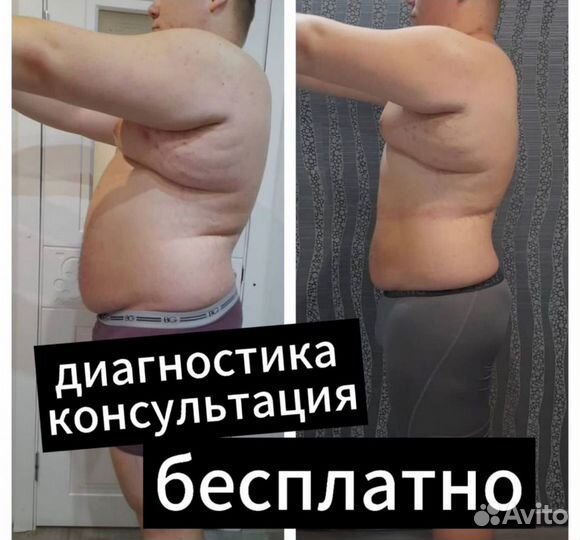 Массаж антицеллюлитный Коррекция фигуры