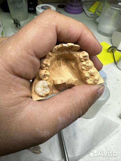 Зубной техник керамист