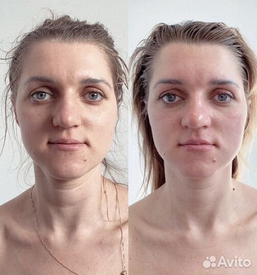 Массаж лица и тела Остеопластика