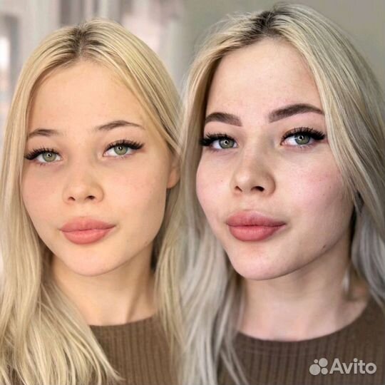 Бровист