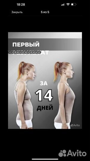 Корсет для осанки