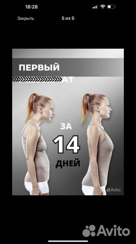 Корсет для осанки