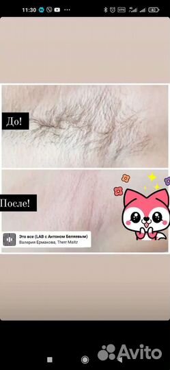 Женская Восковая депиляция