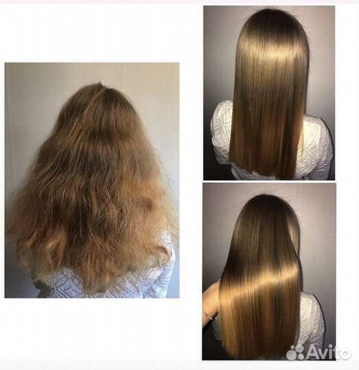 Депиляция