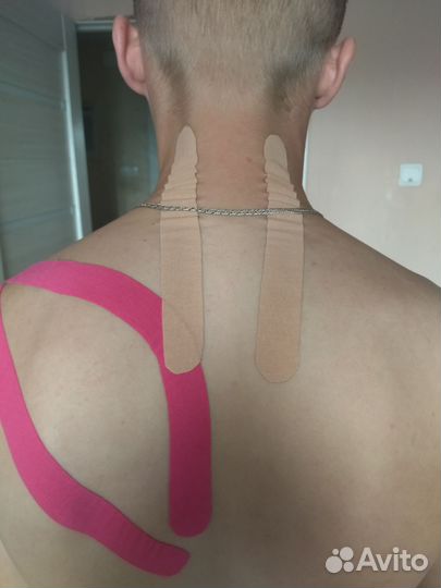 Тейпирование