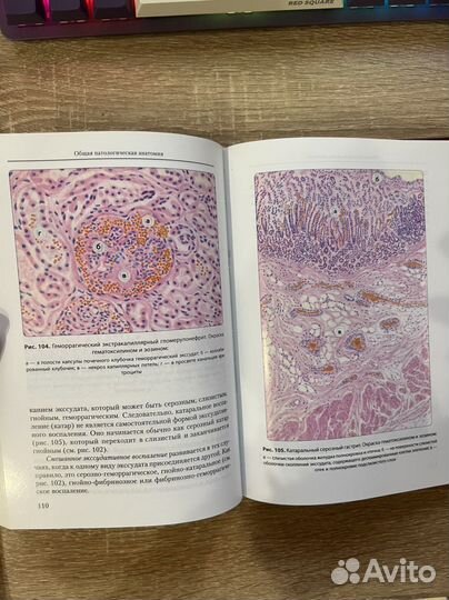 Патологическая анатомия атлас