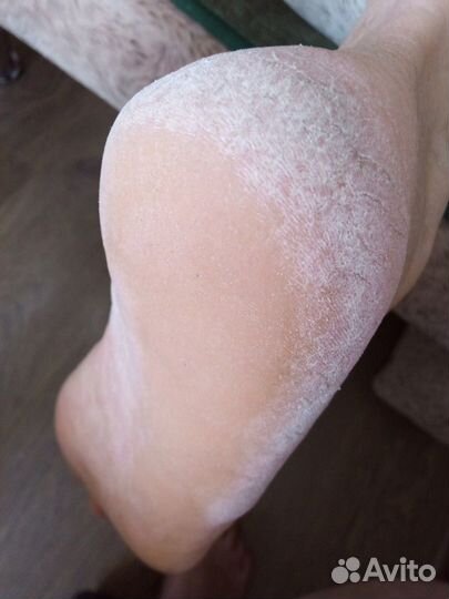 Педикюр,маникюр, коррекция, наращивание Энка