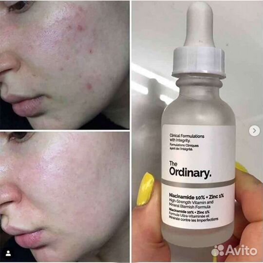 Сыворотка для проблемой кожи The Ordinary