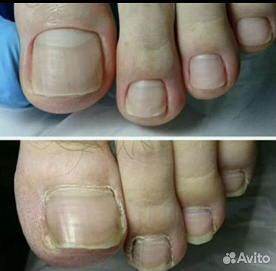 Педикюр, Подолог