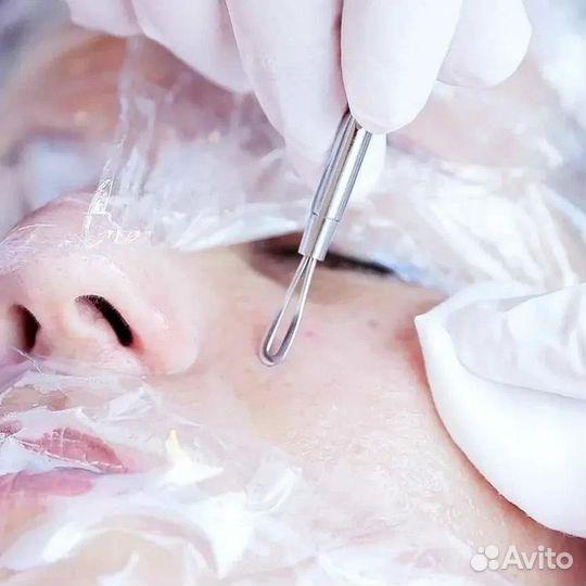 Чистка лица, карбоновый пилинг