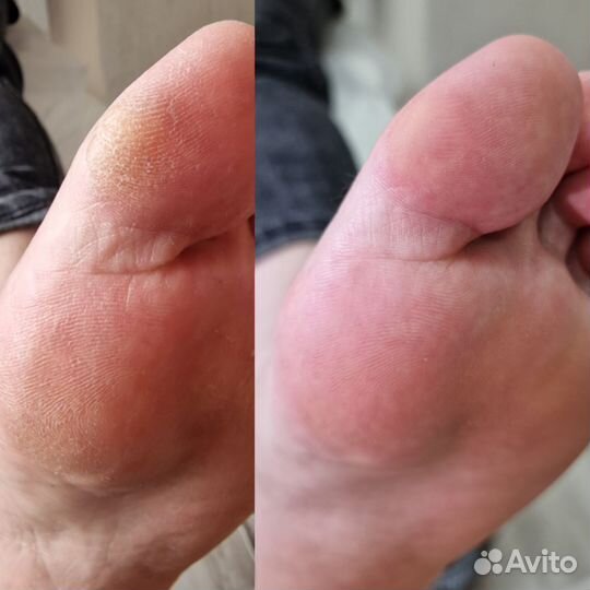 Модель на педикюр