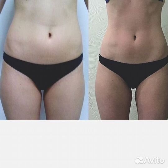 Коррекция фигуры