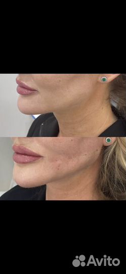 Обучение косметологии