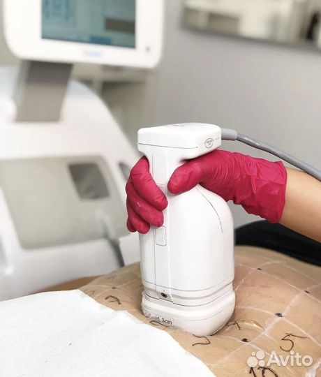 Липосоникс liposonix
