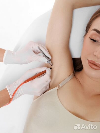 Курсы электроэпиляции в Архангельске