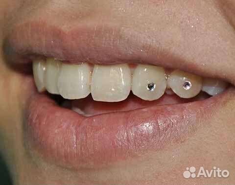 Установка скайса