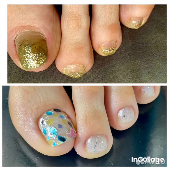 Подолог педикюр