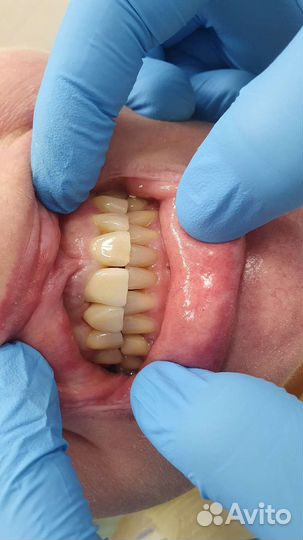 Зубной техник керамист