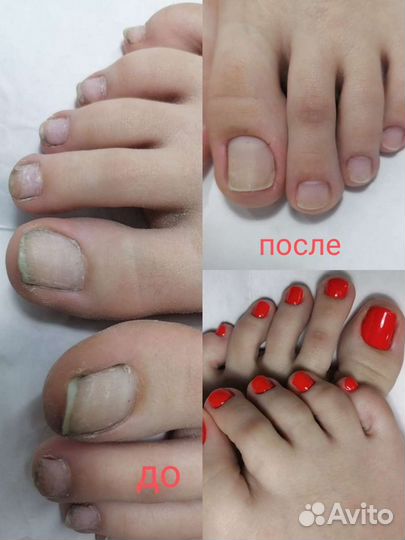 Педикюр мужской