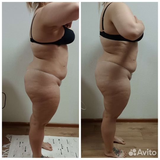 Ищу моделей на ручной антицеллюлитный масаж