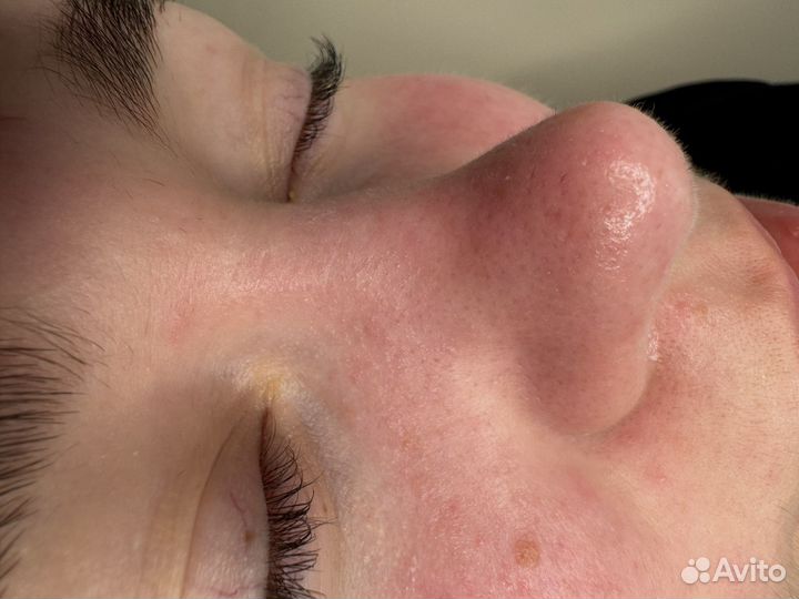 Услуги косметолога эстетиста