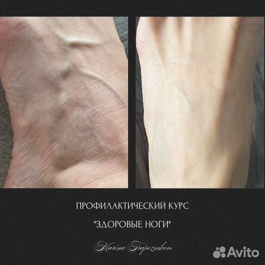 Оздоровительный массаж