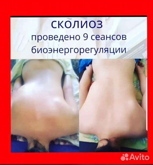 Биоэнергетический массаж