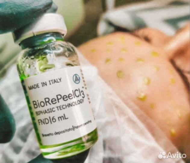 Скульптурно-буккальный массаж лица,рф,чистка лица