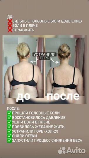 Лечебный массаж в г. Пушкин