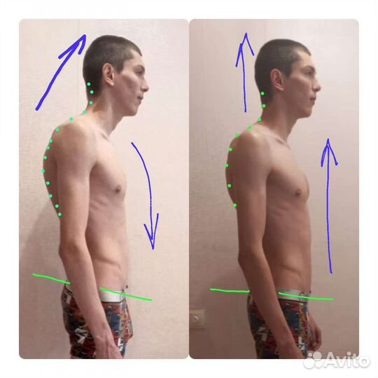 Профессиональный оздоровительный массаж