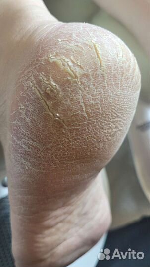 Мастер маникюра и педикюра с выездом на дом