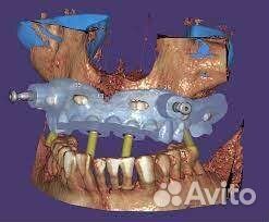 Exoplan 3.1 Rijeka 2023 год