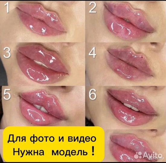 Контурная пластика губ