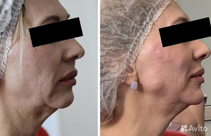 Обучение косметологов