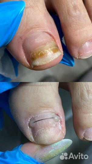 Услуги подолога