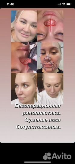 Косметологические услуги