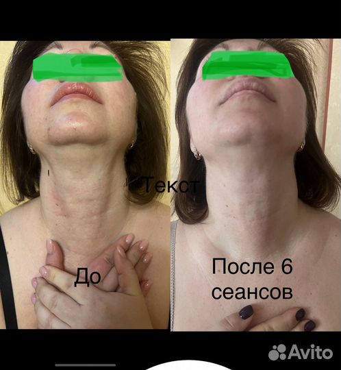 Миофасциальный массаж лица, шеи, головы