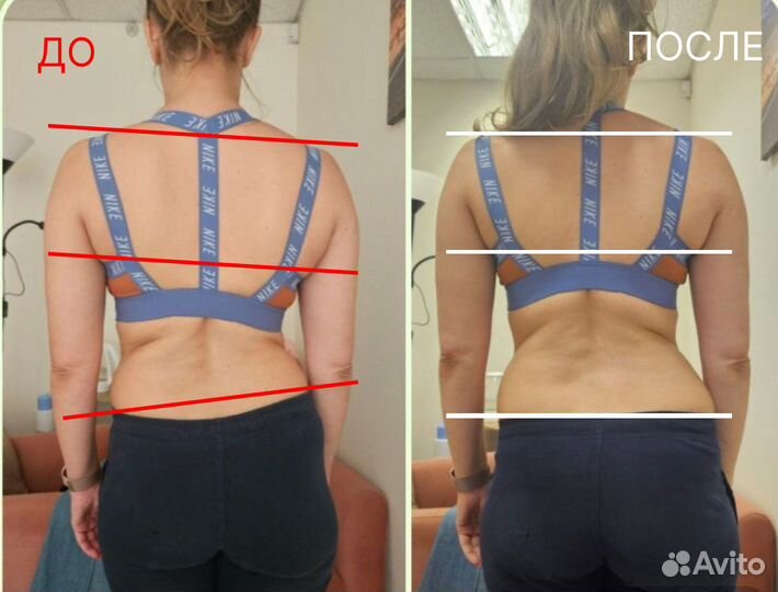 Остеопатический сеанс мануальный остеопат Д