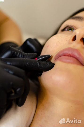 Электроэпилятор Микротерм Микро терм Обучение