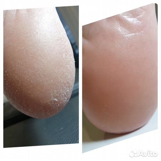 Педикюр,выезд на дом