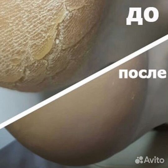 Smart-педикюр