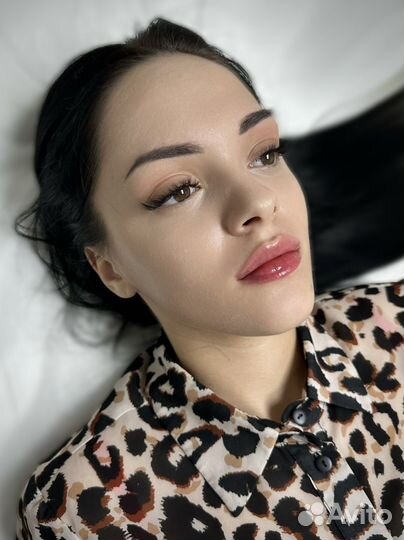 Увеличение губ/Коррекция обьема/Ботокс