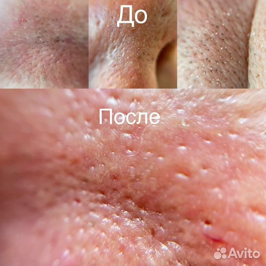 Услуги косметолога