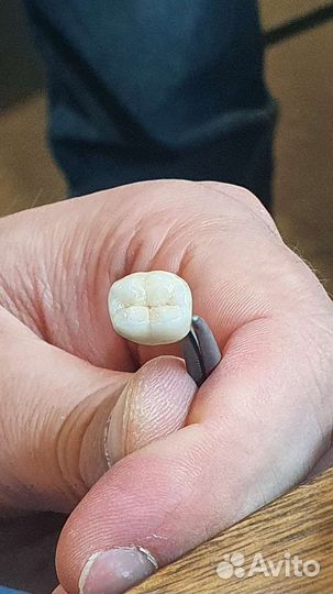 Зубной техник керамист