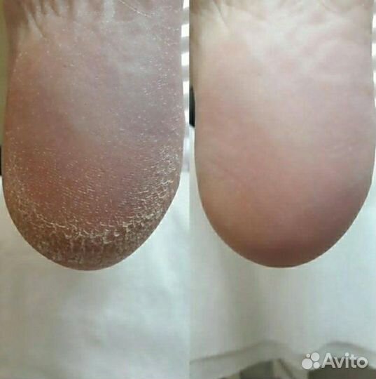 Модели на педикюр