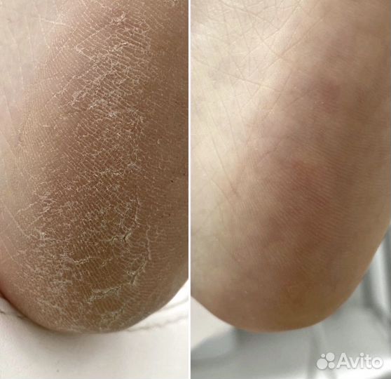 Подолог. Воронеж