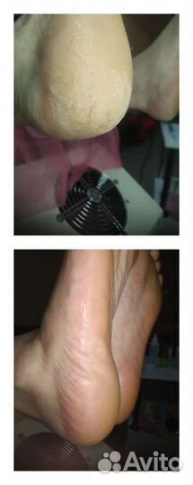 Смарт педикюр