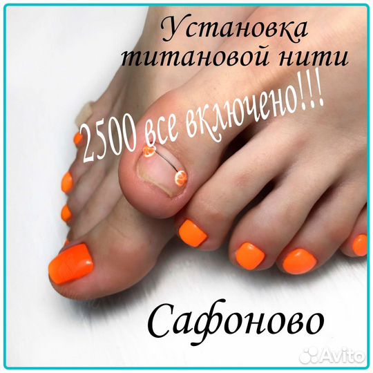 Услуги подолога