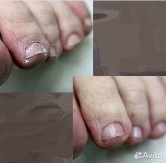 Аппаратный педикюр/эстетика, подология